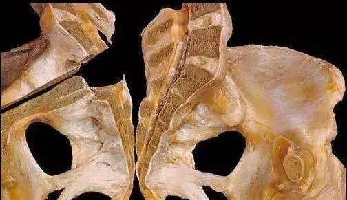 脊柱里有一条存放脊神经的管桡腕关节部位2排4块腕骨的特写这张解剖