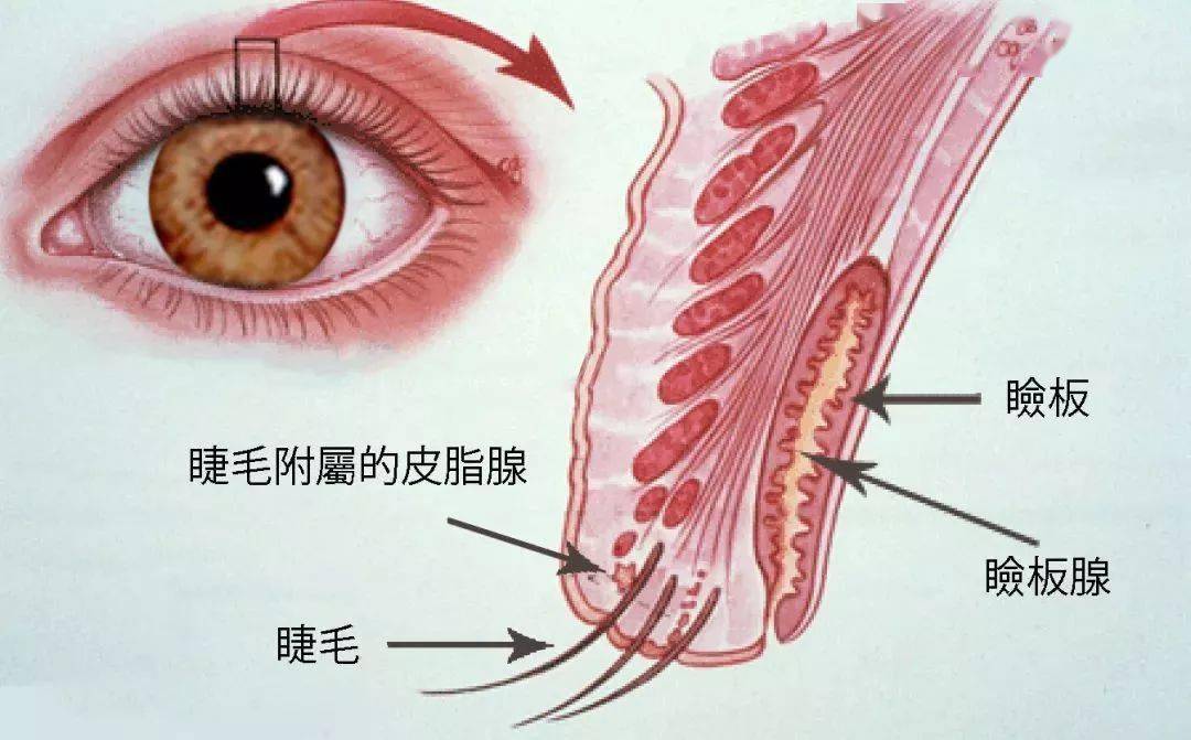 下眼睑结膜囊内示意图图片