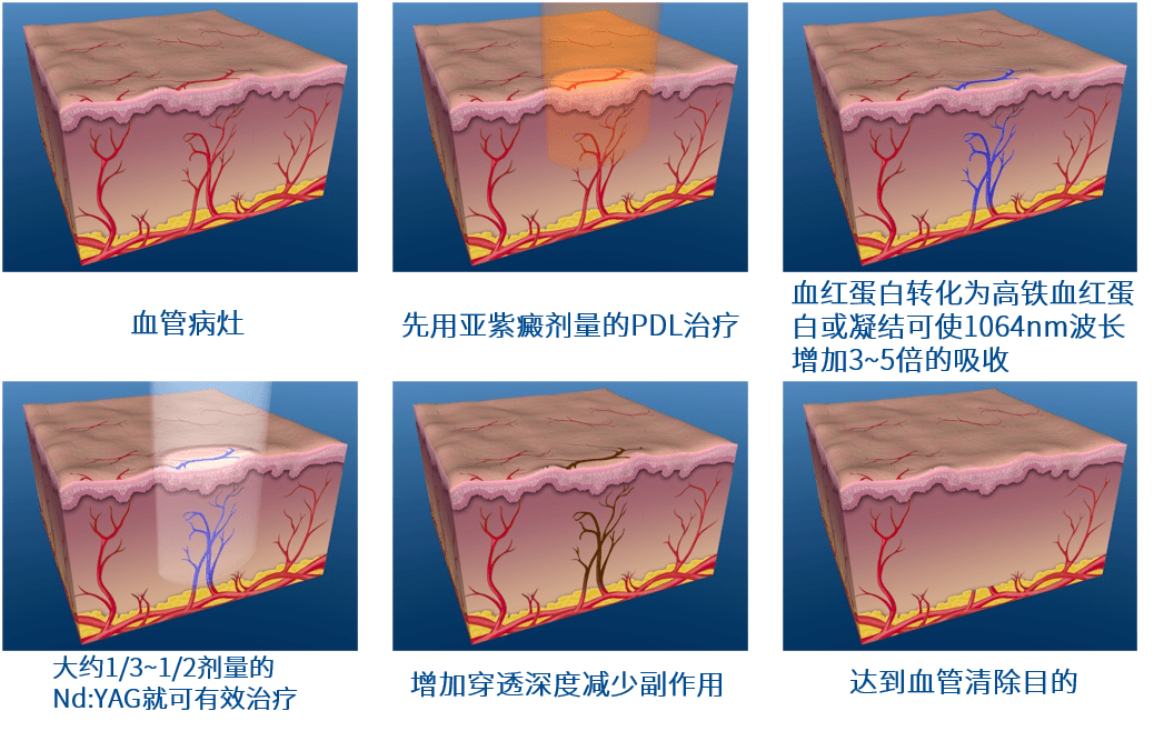 multiplex技术的出现,巧妙地将二者的优势结合,通过调控pdl模块发射亚