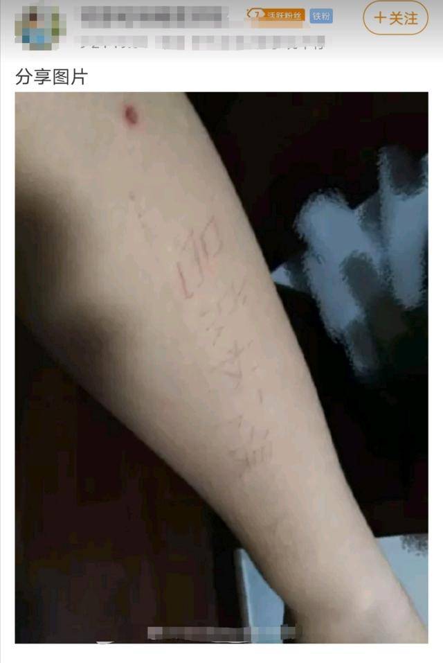 estar猫神出现极端粉丝手臂刻字吕成林下课如此疯狂