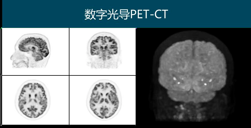 揭秘 | 听说PET-CT一扫,就能知道有没有肿瘤?-搜狐大视野-搜狐新闻