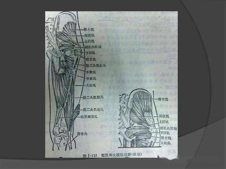 大腿肌肉横断面解剖图图片