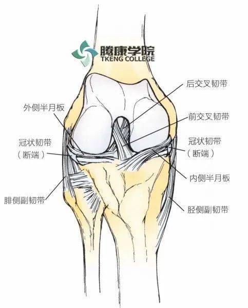 膝关节韧带对关节运动的控制多于人体的其他任何一个关节