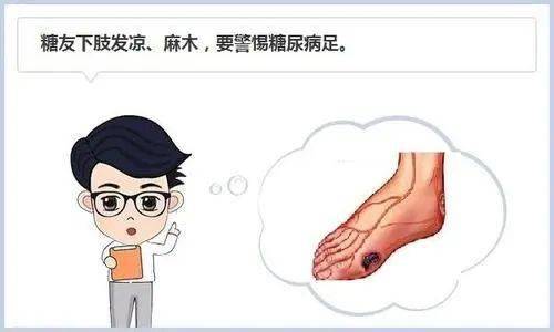 急诊外科科普系列①糖尿病患者脚凉需警惕糖尿病足