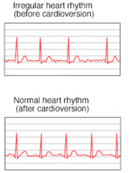 房颤宣教二药物治疗