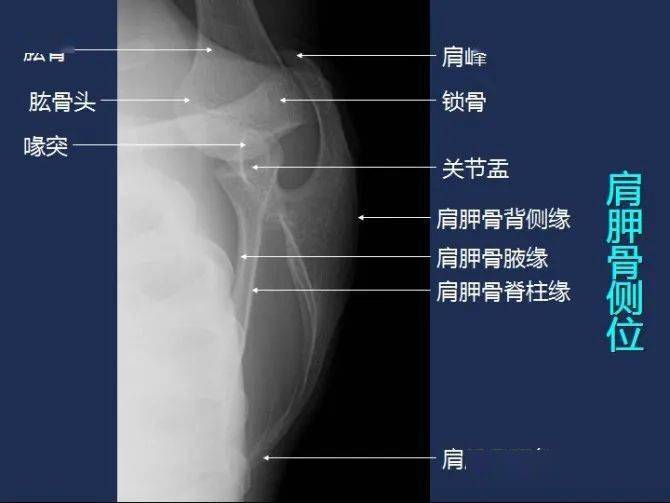 全身x線圖譜閱片必備