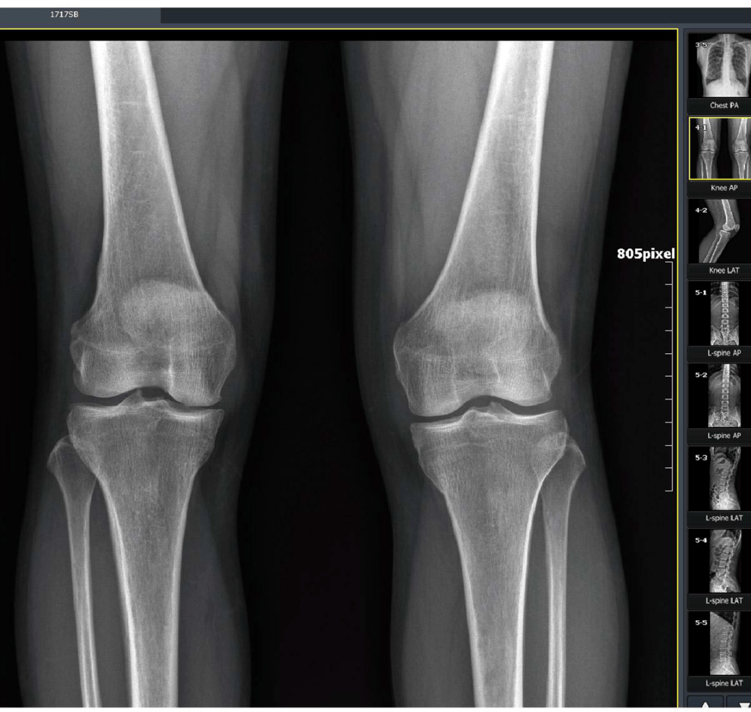放射科"再添利器"---我院引进est全数字配置高端dr_手机搜狐网