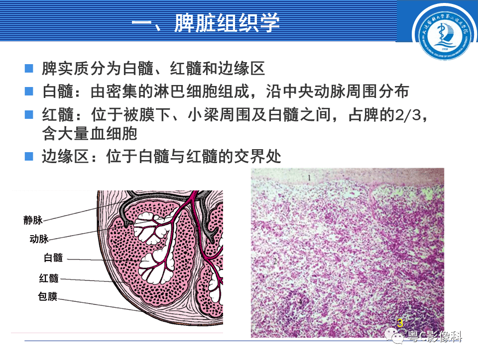 脾脏病变MRI表现_信号