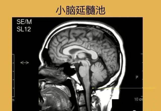 小脑池一个好的方法技巧一定源于一个好的理论知识