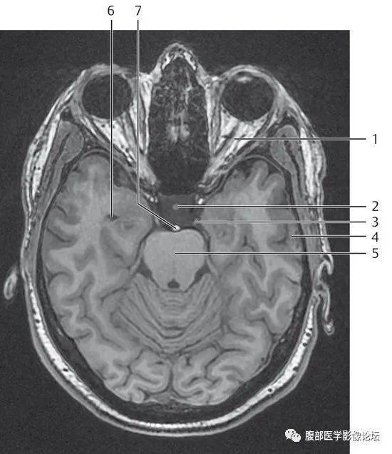 345.頭部磁共振解剖(part 6)