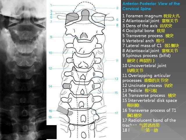 超详细的腰椎x线解剖及解读