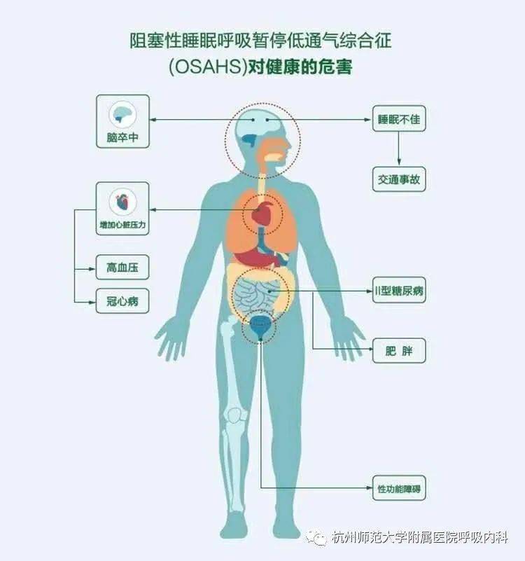 呼噜不得不小心鼾症门诊来帮你