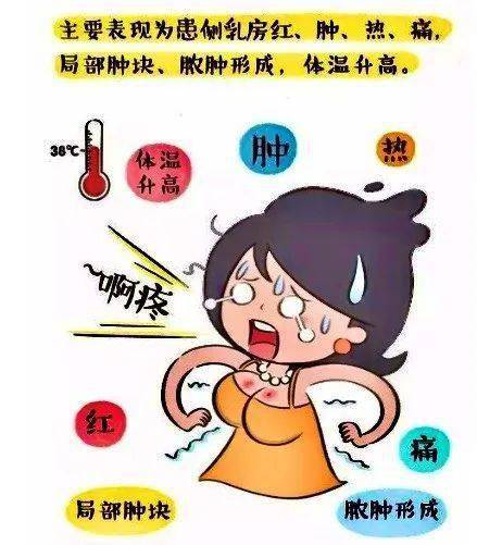 急性乳腺炎是一种乳腺急性,化脓性感染,一般表现为乳房肿胀,按压患处