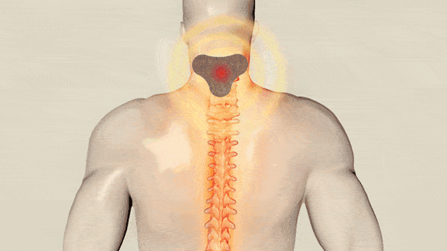 脖子僵硬"咔嚓响"!后面看还虎背熊腰,原来是它在作怪…_颈椎