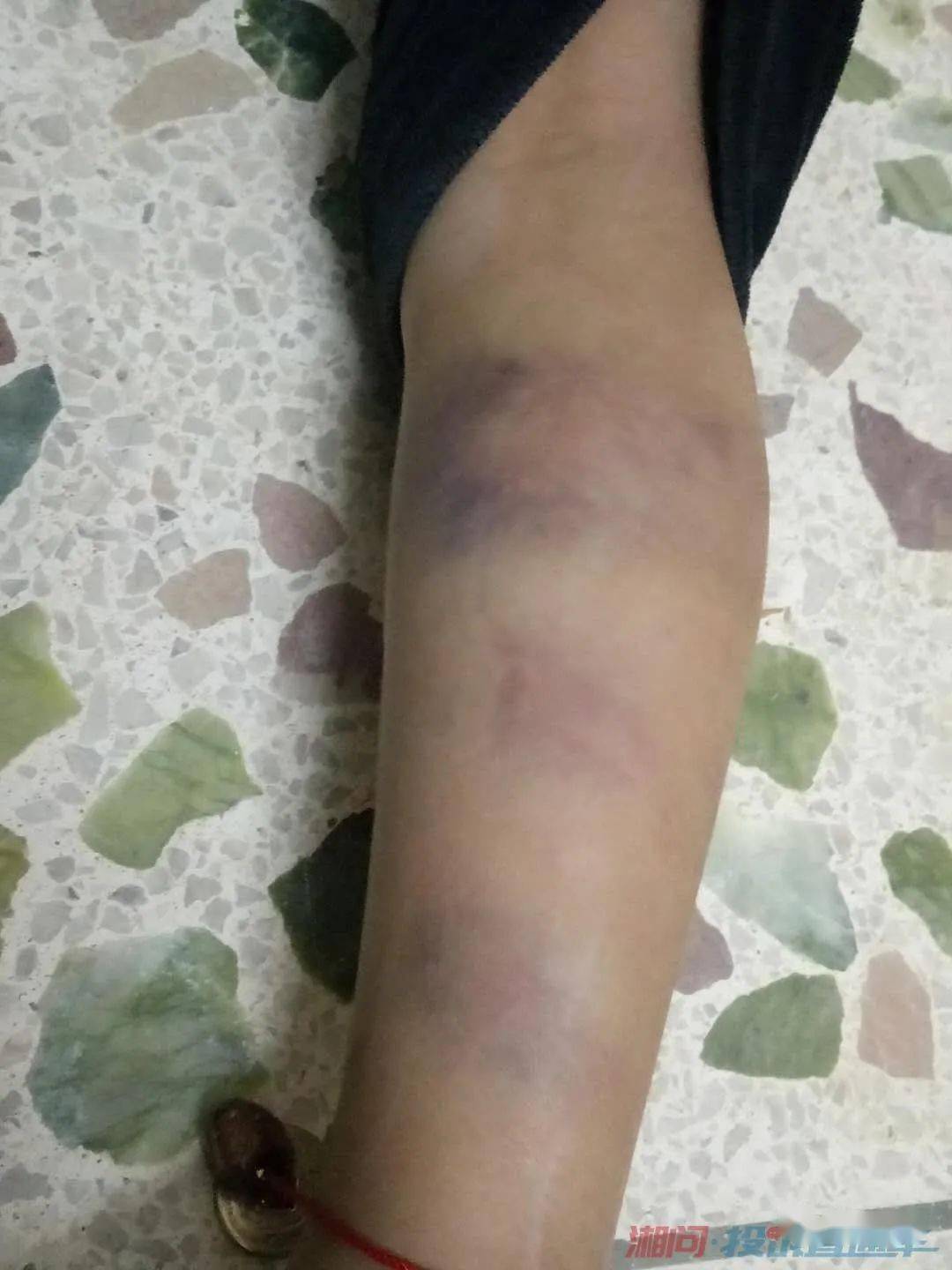 大家关心的隆回一小学老师殴打学生事件又有新的情况调查来了