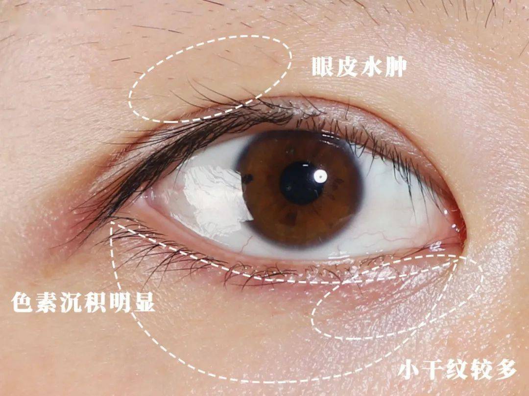 3d胜肽对眼周进行提拉按摩的同时,品牌精心研制的24k纳米金,可以通过