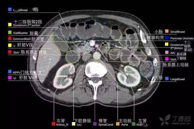 收藏丨全腹部高清ct图谱,淋巴结彩色图谱,血管解剖图谱大汇总!