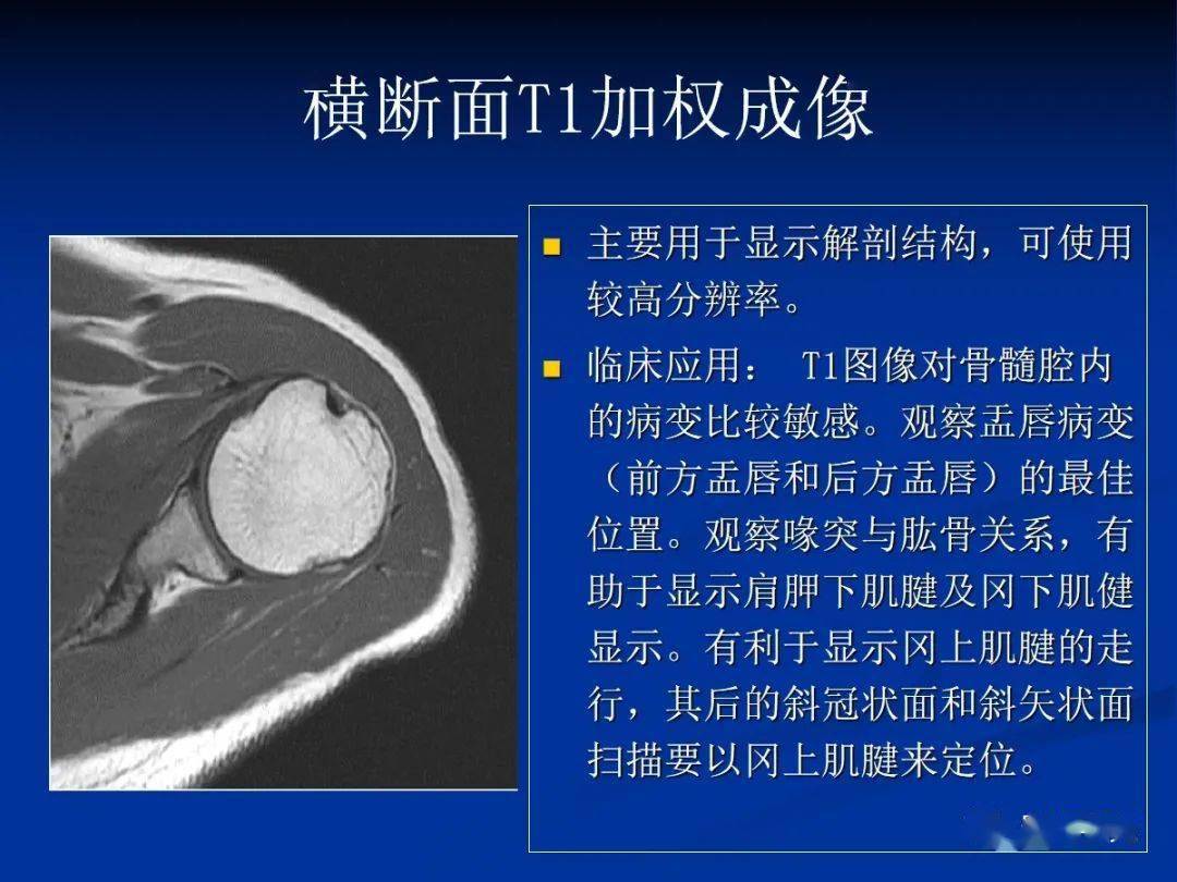 一个盂唇 二个关节:盂肱关节,肩锁关节.