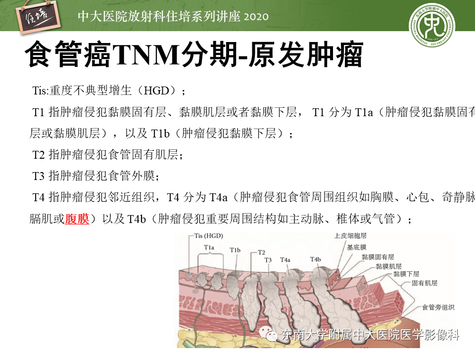 【中大放射住培系列讲座】食管癌影像-临床分期