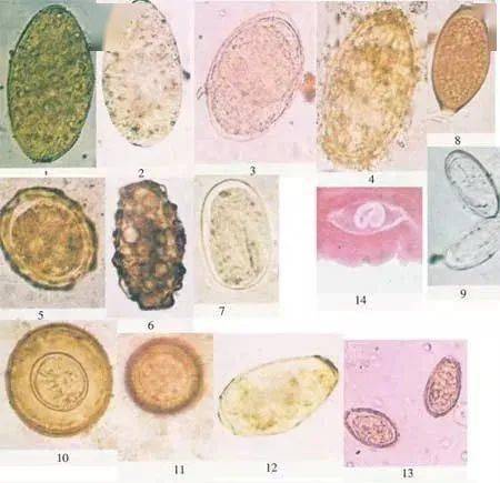 粪便镜检图谱解析图片
