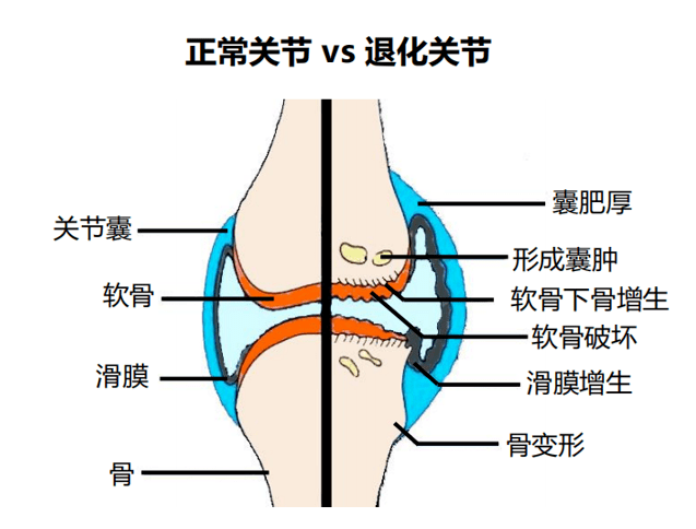 运动时膝关节咔咔响,还能跑步吗?其实真相!很简单