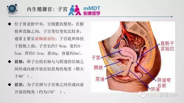 子宫附件影像解剖