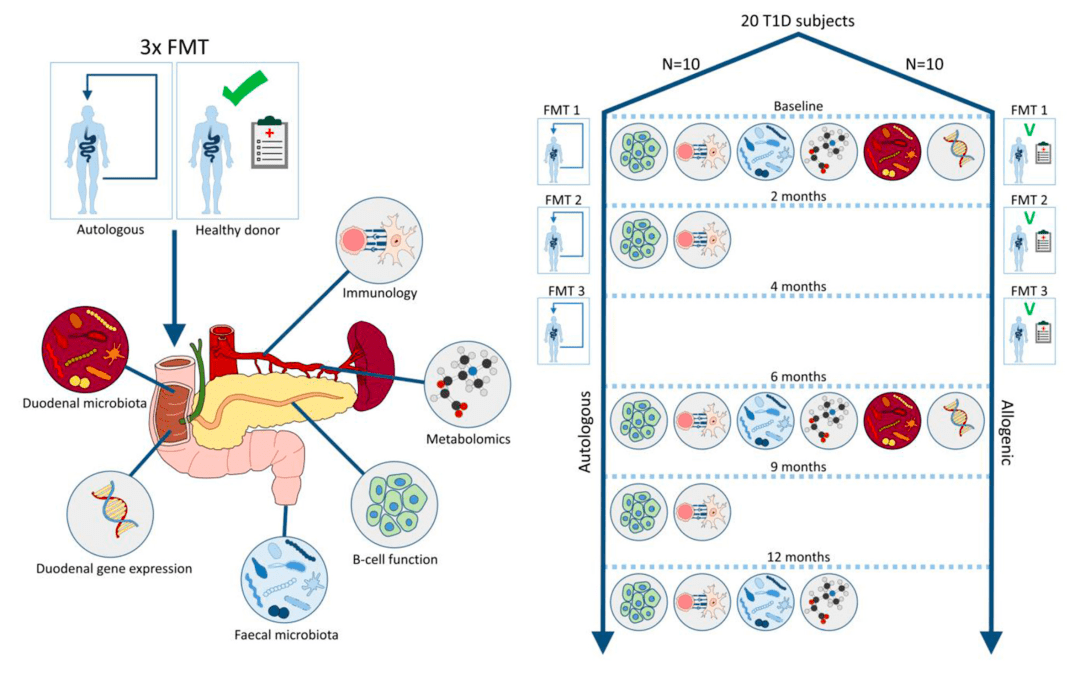 首個人體臨床試驗發現,糞便微生物群移植可穩定新發1型糖尿病患者殘餘