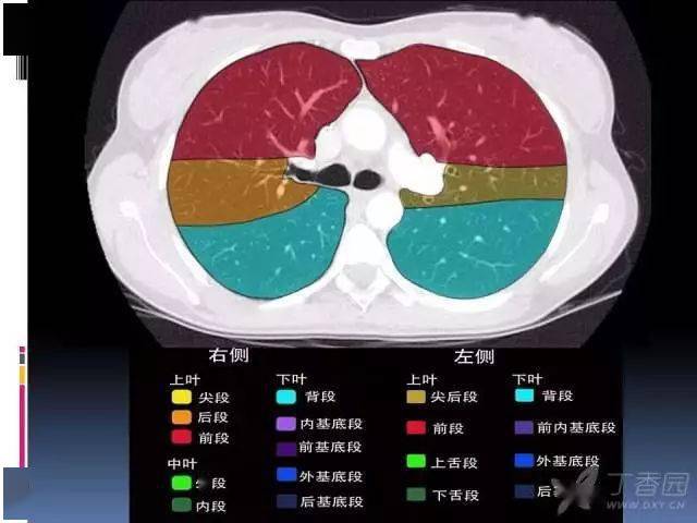 左上肺上舌段的位置图图片