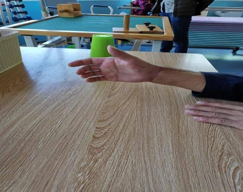 指尖上的舞蹈手部康复功能锻炼