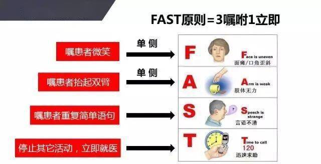 判断脑卒中简单快速的办法是fast准则:3.脑卒中前兆,如何判断?