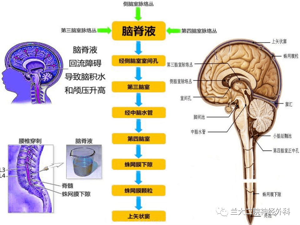 ppt腦脊液漏的觀察與護理