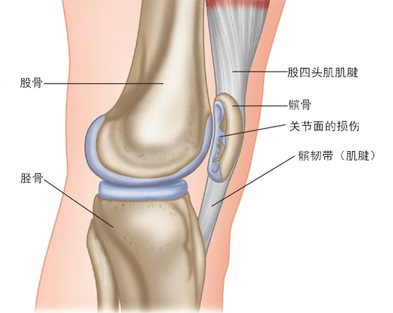 髌骨外侧支持带解剖图图片