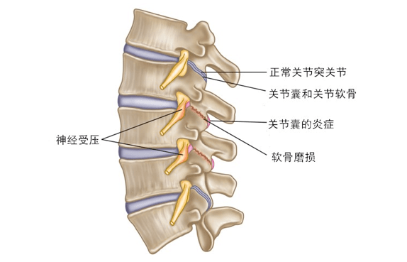 关节突关节解剖图图片