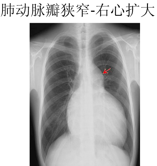 x线双房影图片图片