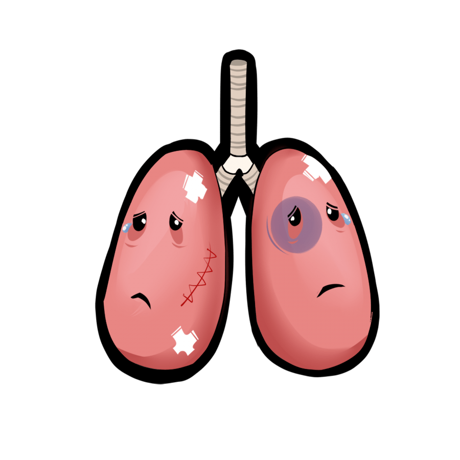 我院开展嘉兴市首例重症呼吸衰竭患者的肺泡蛋白沉积症全肺灌洗术