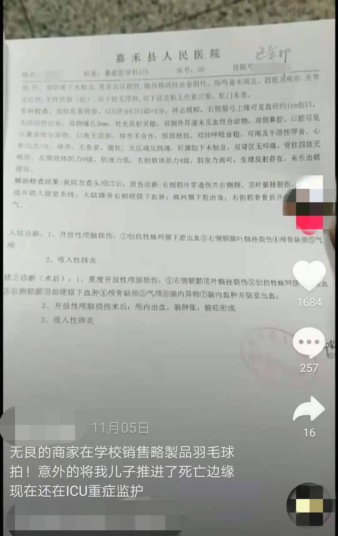 病历显示,小雷为重度开放性颅脑损伤