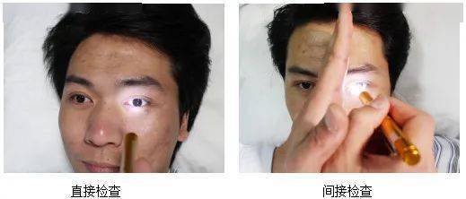 视网膜→视神经→视交叉→同侧及对侧视束→上丘臂→中脑顶盖前区(光