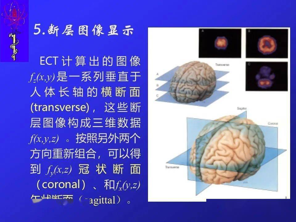 核汇园39期刘亚强研究员核医学断层成像方法