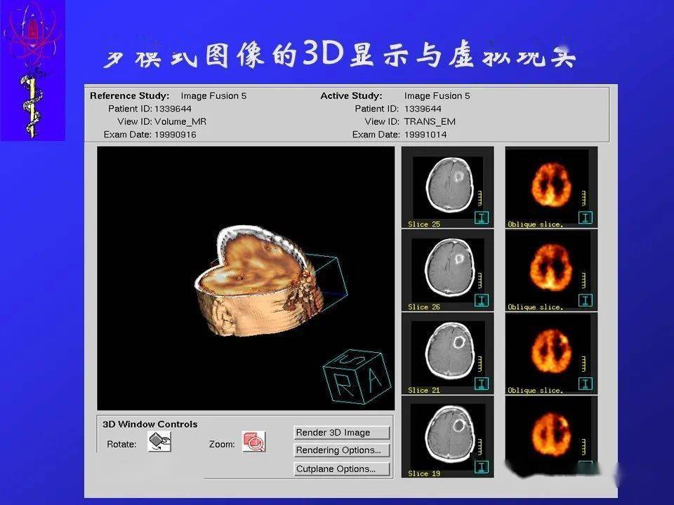核汇园39期刘亚强研究员核医学断层成像方法