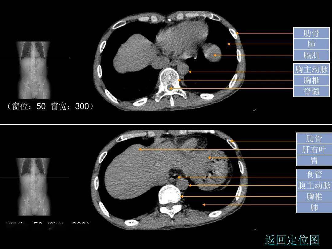 腹部ct入门解剖图谱收藏版