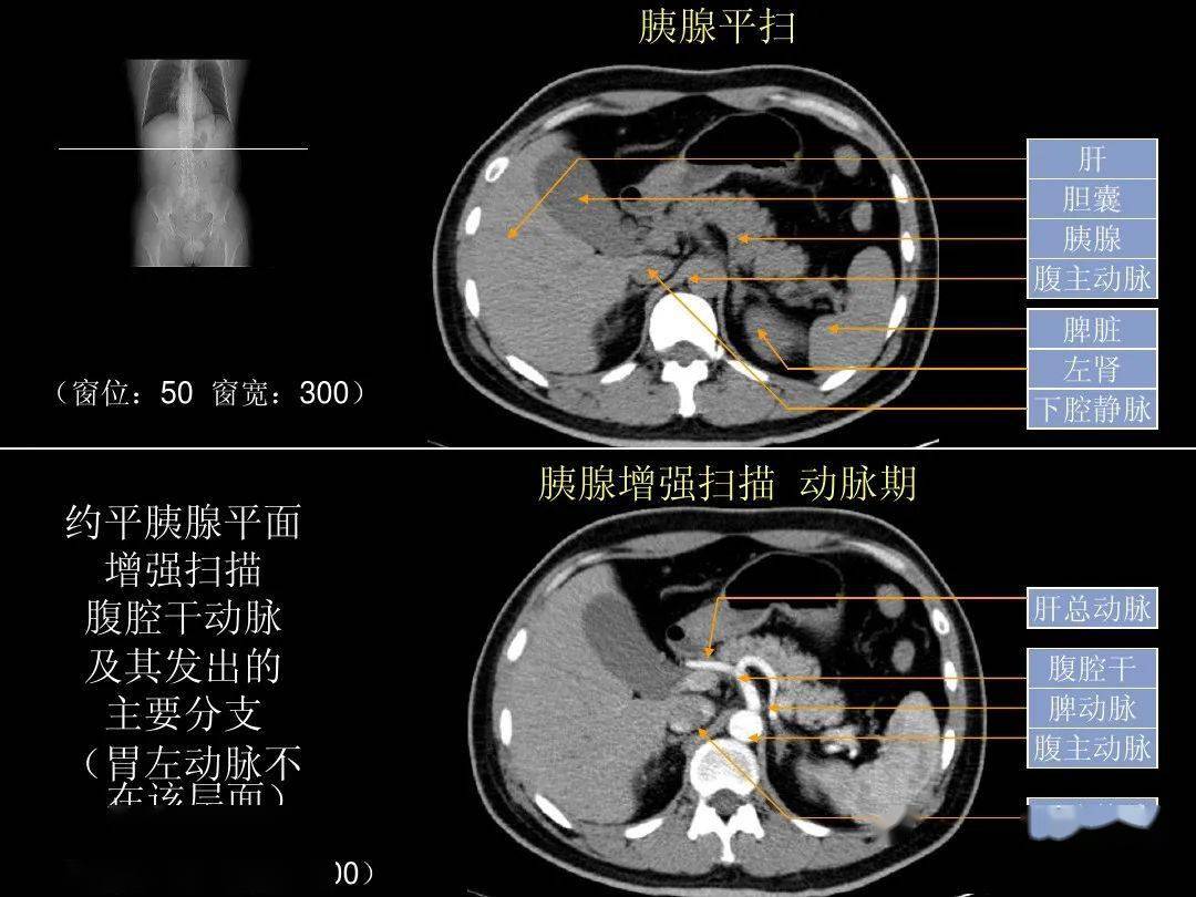 精品高清图谱腹部ct应用入门必备