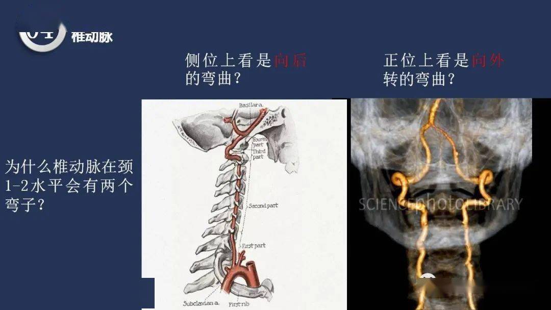 高清頭頸動脈系統解剖