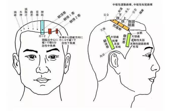 额头反射区图图片