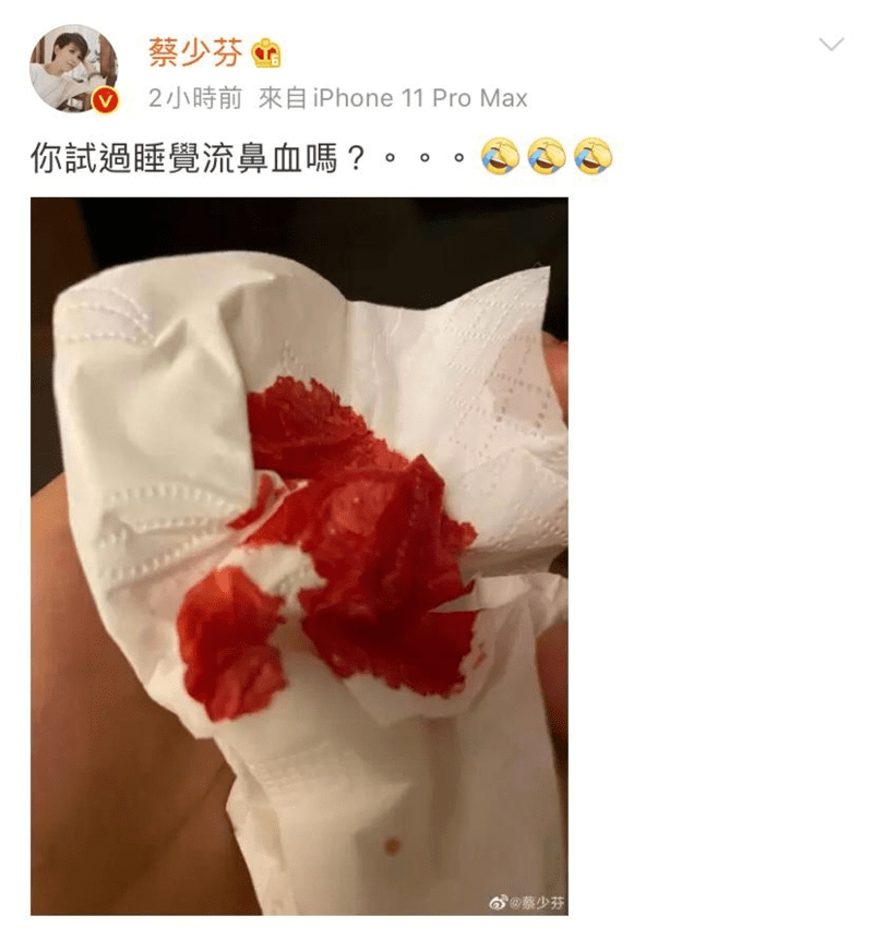 突然在微博上载一张染满鲜血的纸巾照片并留言问:你试过睡觉流鼻血吗