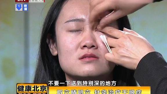 健康北京针灸治疗干眼症要取睛明穴中医老师现场演示效果