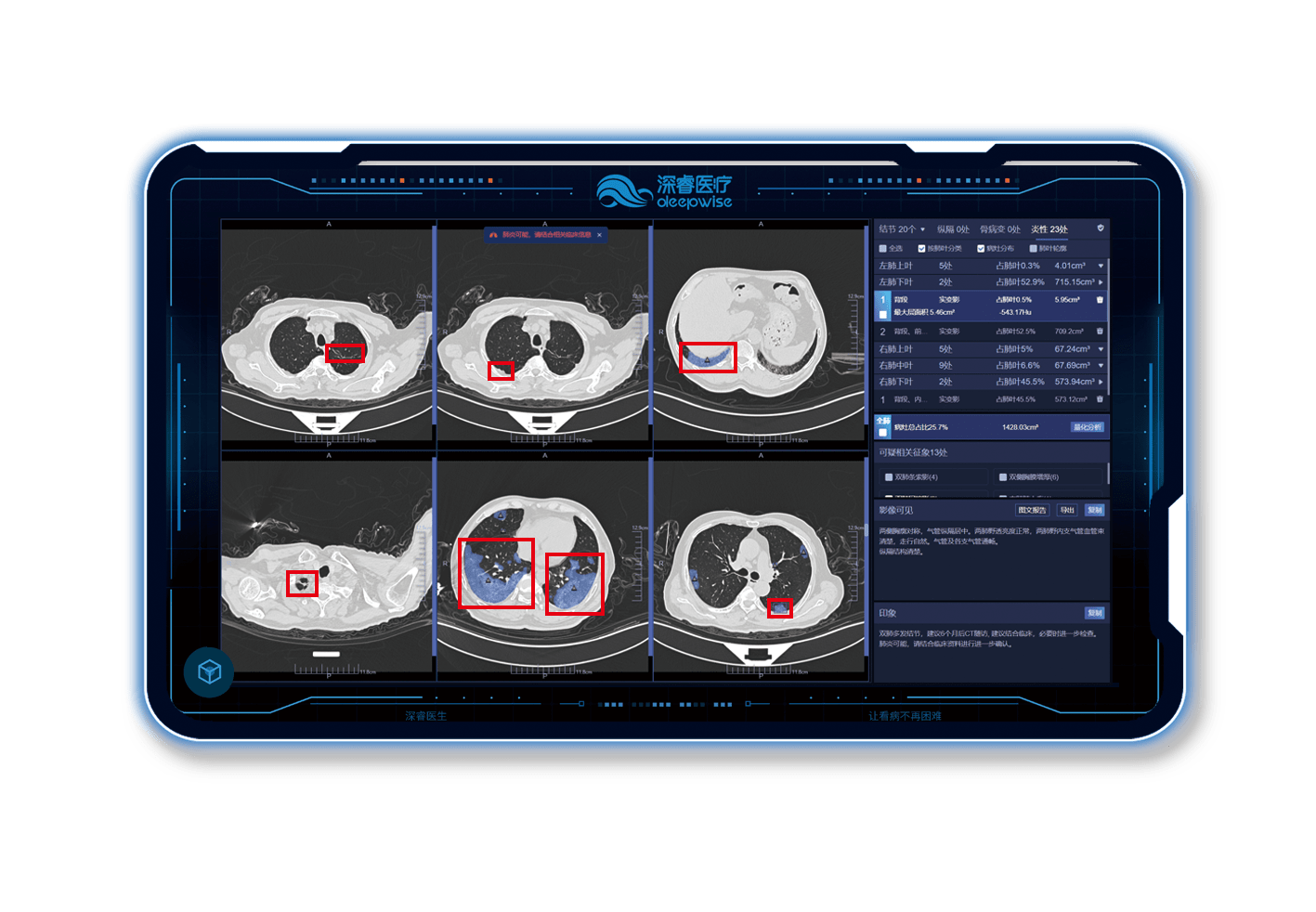 36氪首发丨医疗ai研发商深睿医疗完成数亿元c轮融资已获批中国创新ai