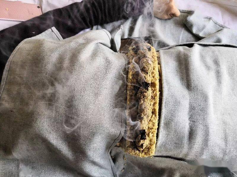 中医特色疗法带脉灸