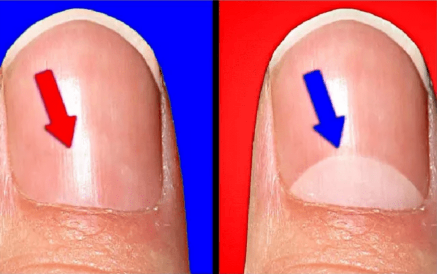 指甲上月牙小的人就是不健康的吗快来看看吧