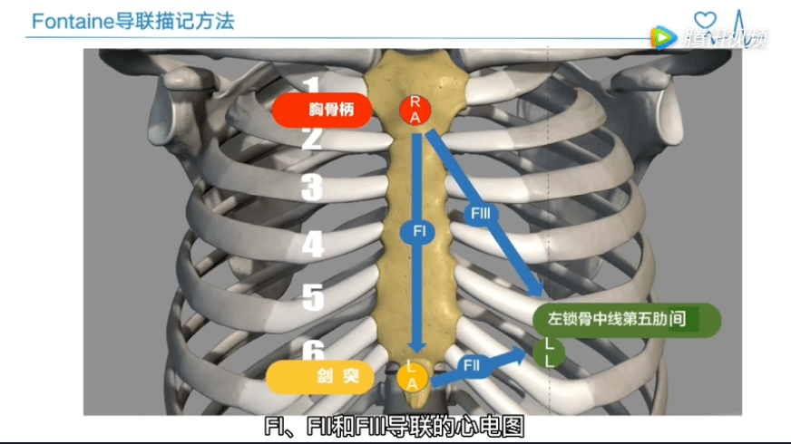 fontaine导联将ra置于胸骨柄,la置于剑突下,ll置于第五肋间锁骨中线
