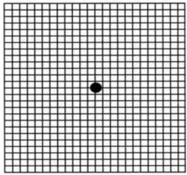 眼睛看东西变形扭曲当心眼睛在报警